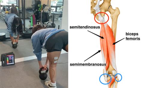 A Smarter Way to Rehab Hamstring Injuries - mTrigger