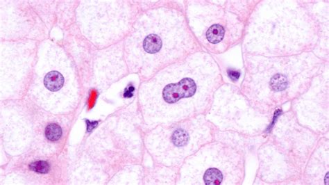 What is amitosis in cell division - ScienceQuery