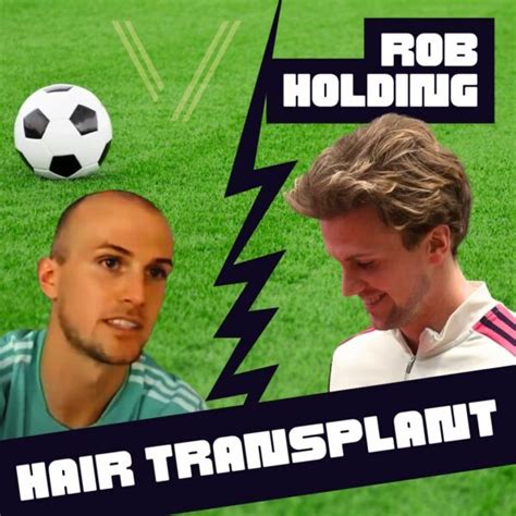 Rob Holding's Hair Transplant: Before and After Transformation