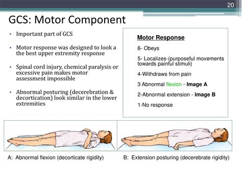 PPT - Traumatic Brain Injury Module for DSHS PowerPoint Presentation ...