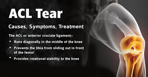 ACL tear – Causes, Symptoms, Treatment | Kauvery Hospital