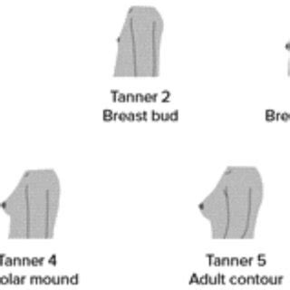 Tanner staging of breast (Lecturio, 2020) | Download Scientific Diagram