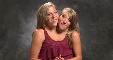 Conjoined Twins Abby and Brittany Hensel Now Work as Teachers