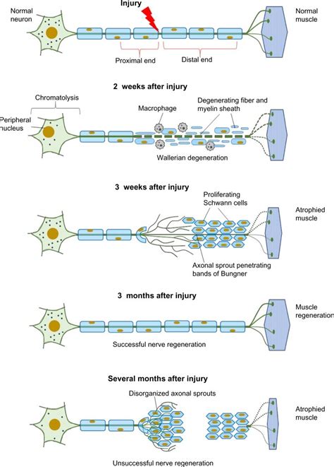 Cellular responses to nerve injury: nerve degeneration and regeneration ...