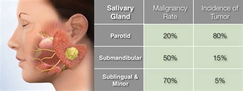 Parotid Tumor Treatment Los Angeles | Dr. Larian