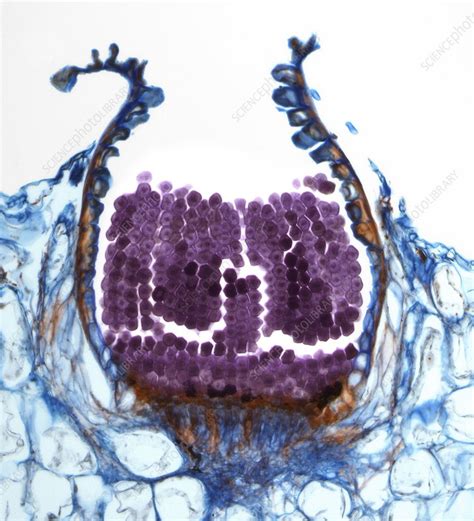 Rust fungus spore, light micrograph - Stock Image - F006/9817 - Science ...