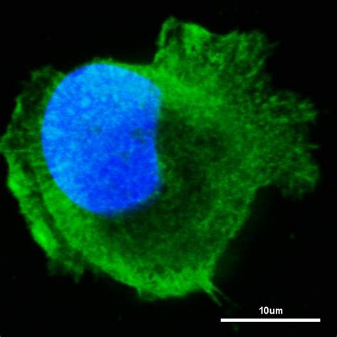 Paxillin (focal adhesion protein) in a human pancreatic cell line ...