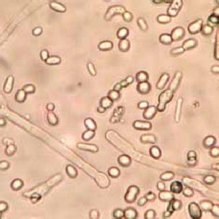 (A) Gross morphology of Trichosporon species showing cream-colored ...