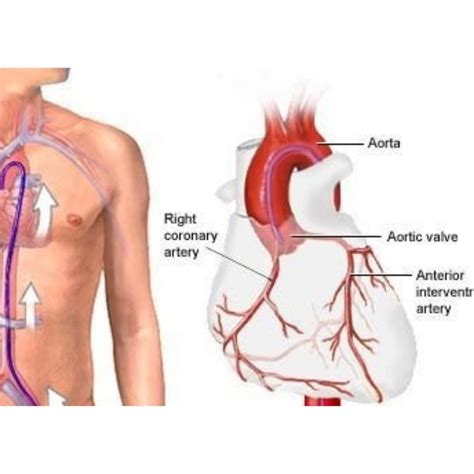 Coronary Angiography Treatment in Pune | Dr. Rahul Patil