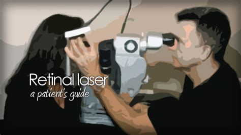 Laser retinal photocoagulation