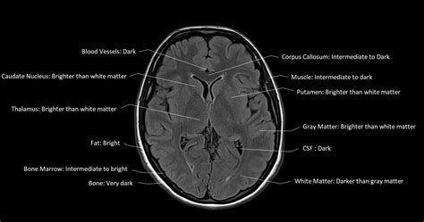 FLAIR vs STIR MRI | FLAIR vs STIR MRI image comparison