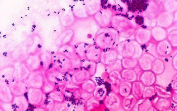 Corynebacterium Jeikeium Gram Stain