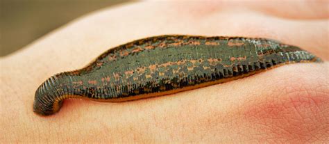 Leech therapy: background, processes and effects – Med Leeches