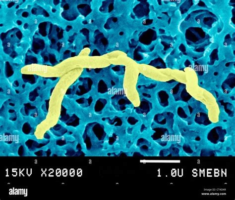 Campylobacter jejuni bacteria hi-res stock photography and images - Alamy