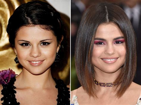 Selena Gomez Before and After: A Skincare Journey