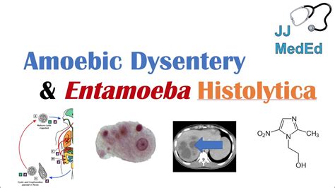 Pathogenesis Of Entamoeba Histolytica