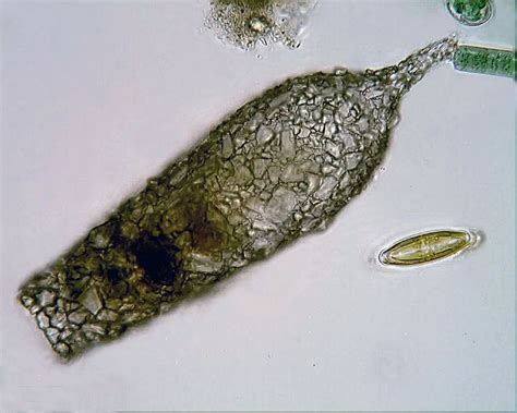 Shell of the testate amoeba Difflugia acuminata. | Microscopic ...