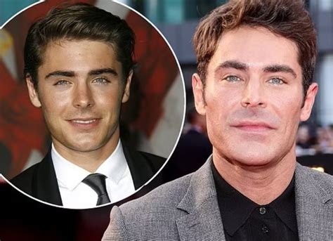 What Happened To Zac Efron Jaw Surgery? Face Change & Plastic Surgery ...