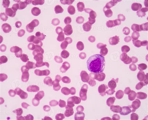 Promyelocyte. 936842 Stock Photo at Vecteezy