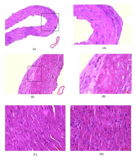 Histology and morphology of thoracic aorta and myocardial tissues ...