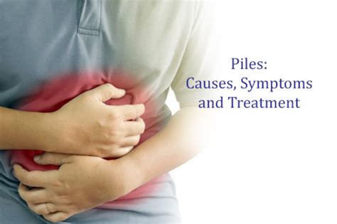 What is Piles Cause, Symptoms and Treatment – Laser piles Clinic