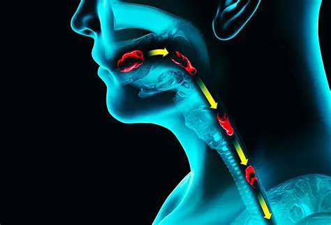 What Is the Difference Between Odynophagia and Dysphagia?