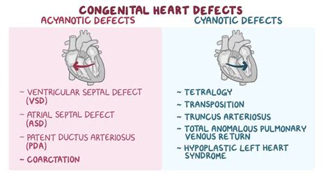 Congenital heart defects: Clinical: Video & Anatomy | Osmosis