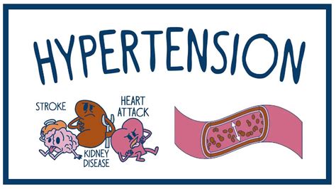 Hypertension Animation