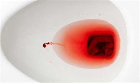 Bowel cancer symptoms: Do you have bloody poo? It could be a sign of ...