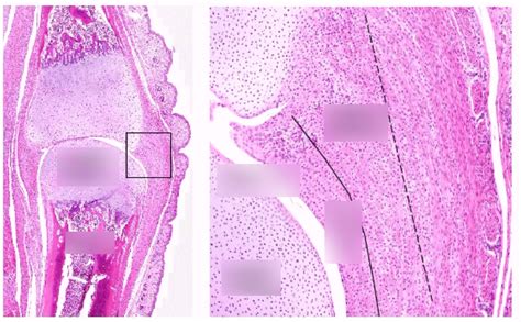 Synovial joint Histology Diagram | Quizlet