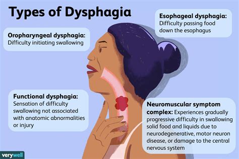 Causes Of Dysphagia