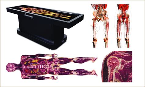 The Anatomage Table (upper left image) and representations of the ...