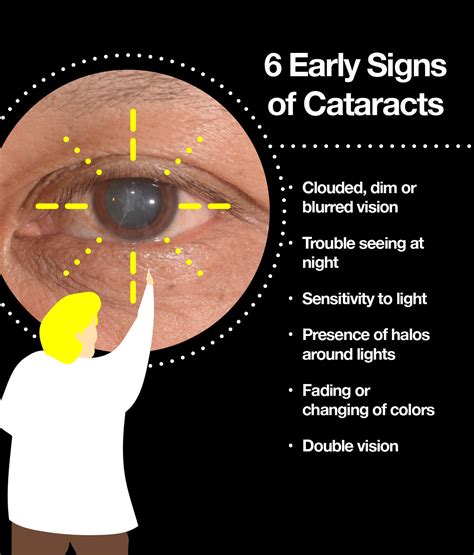 Cataract Is Caused By