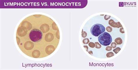 Difference Between Monocytes and Lymphocytes Under Microscope.