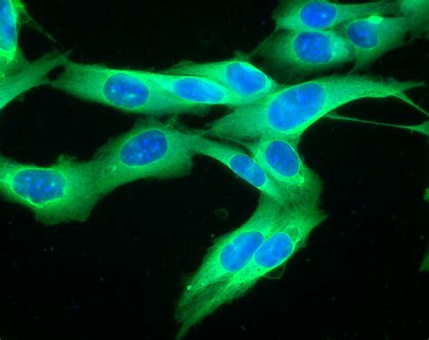 Advancing Multiplexing in Immunofluorescence with Specific Secondary ...