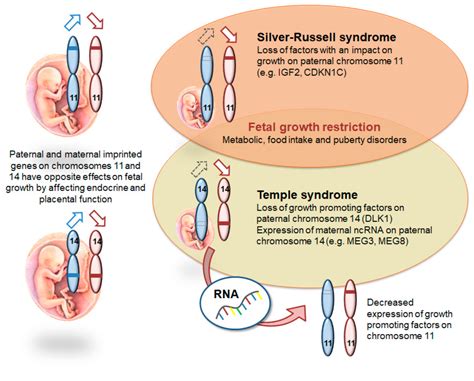 Genes | Free Full-Text | Growth Restriction and Genomic Imprinting ...