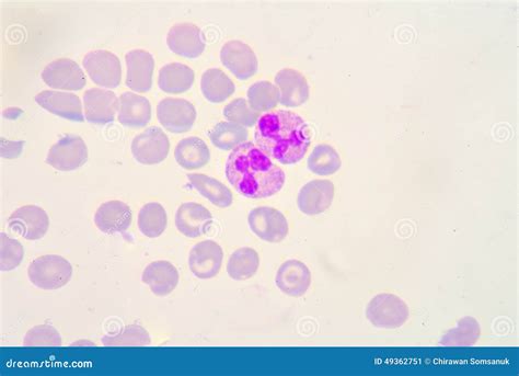 Segmented neutrophils stock image. Image of biology, band - 49362751