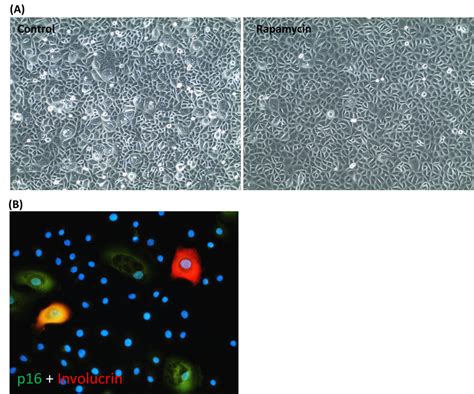 Rapamycin retards epigenetic ageing of keratinocytes independently of ...