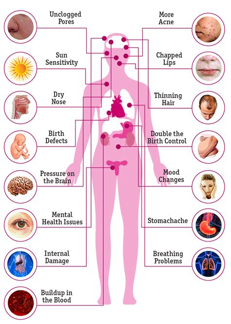 Accutane: What Are the Side Effects on the Body? | Accutane, Best acne ...