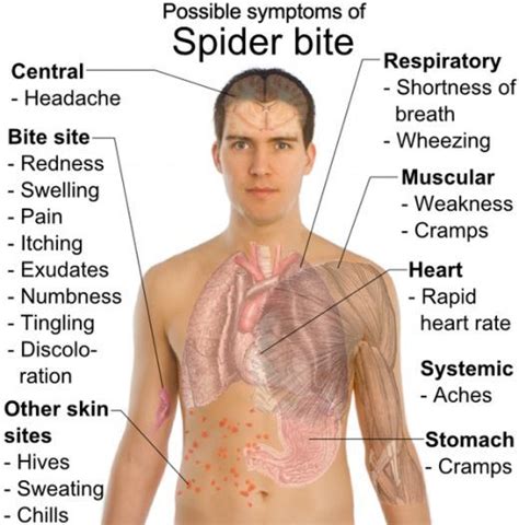 If you suspect you have been bitten by a Black Widow or another type of ...