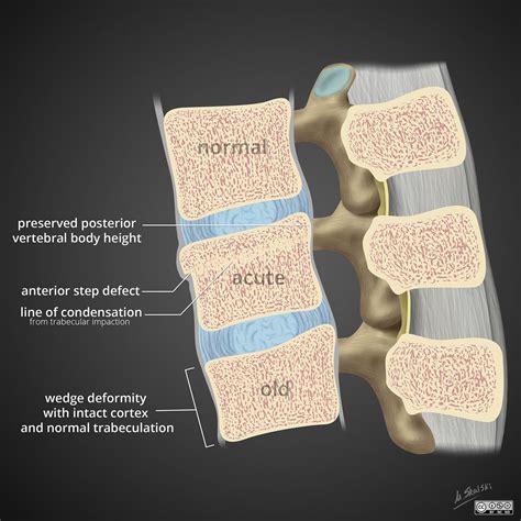 Pin on Musculoskeletal Radiology