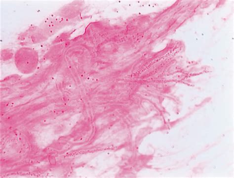 Community Eye Health Journal » Gram stain