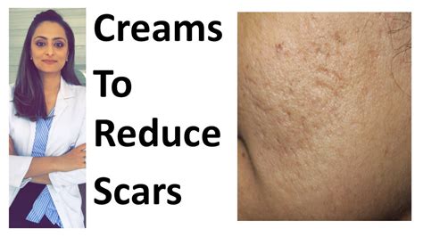 How to remove scars | Scar creams | tretinoin | Tazarotene | dr ...