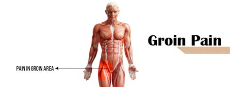 Groin pain – Diversified Integrated Sports Clinic | Abu Dhabi