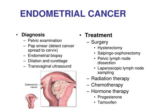 PPT - Endometrial Cancer PowerPoint Presentation, free download - ID:221956