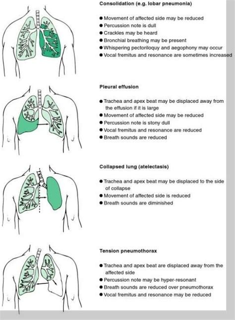 Pin on Nursing