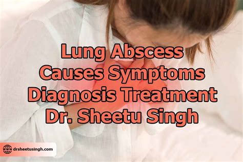 Lung Abscess - Causes, Symptoms, Diagnosis, Treatment & Consultant