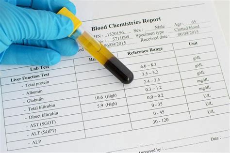 Know Your Symptoms: When To Check Urobilinogen In Urine Normal Range