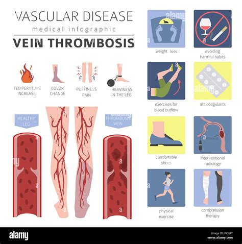 Blood condition Cut Out Stock Images & Pictures - Alamy