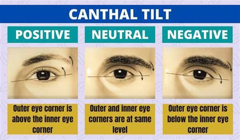 Does Your Canthal Tilt Affect Your Face Attractiveness?